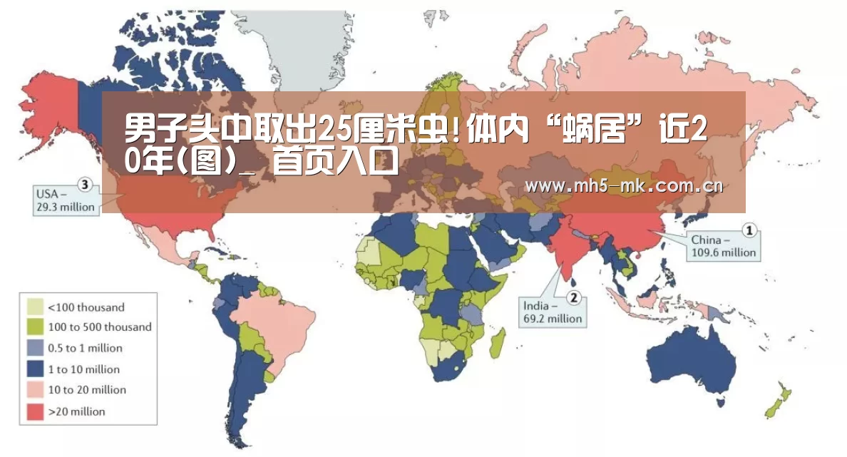 男子头中取出25厘米虫!体内“蜗居”近20年(图)_ 首页入口(图2) MK体育