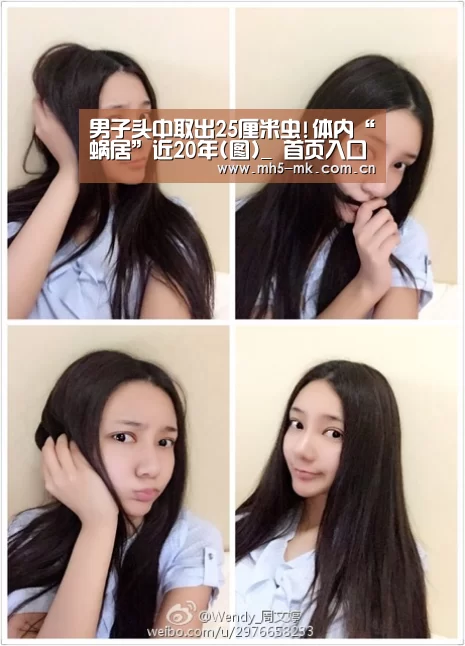 男子头中取出25厘米虫!体内“蜗居”近20年(图)_ 首页入口(图1) 首页入口