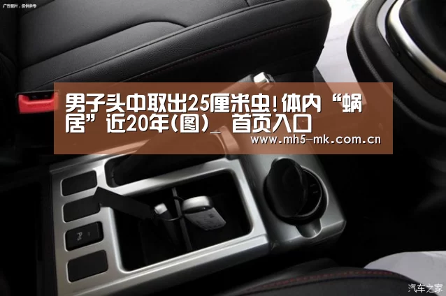 男子头中取出25厘米虫!体内“蜗居”近20年(图)_ 首页入口(图4) MK SPORTS官方网站